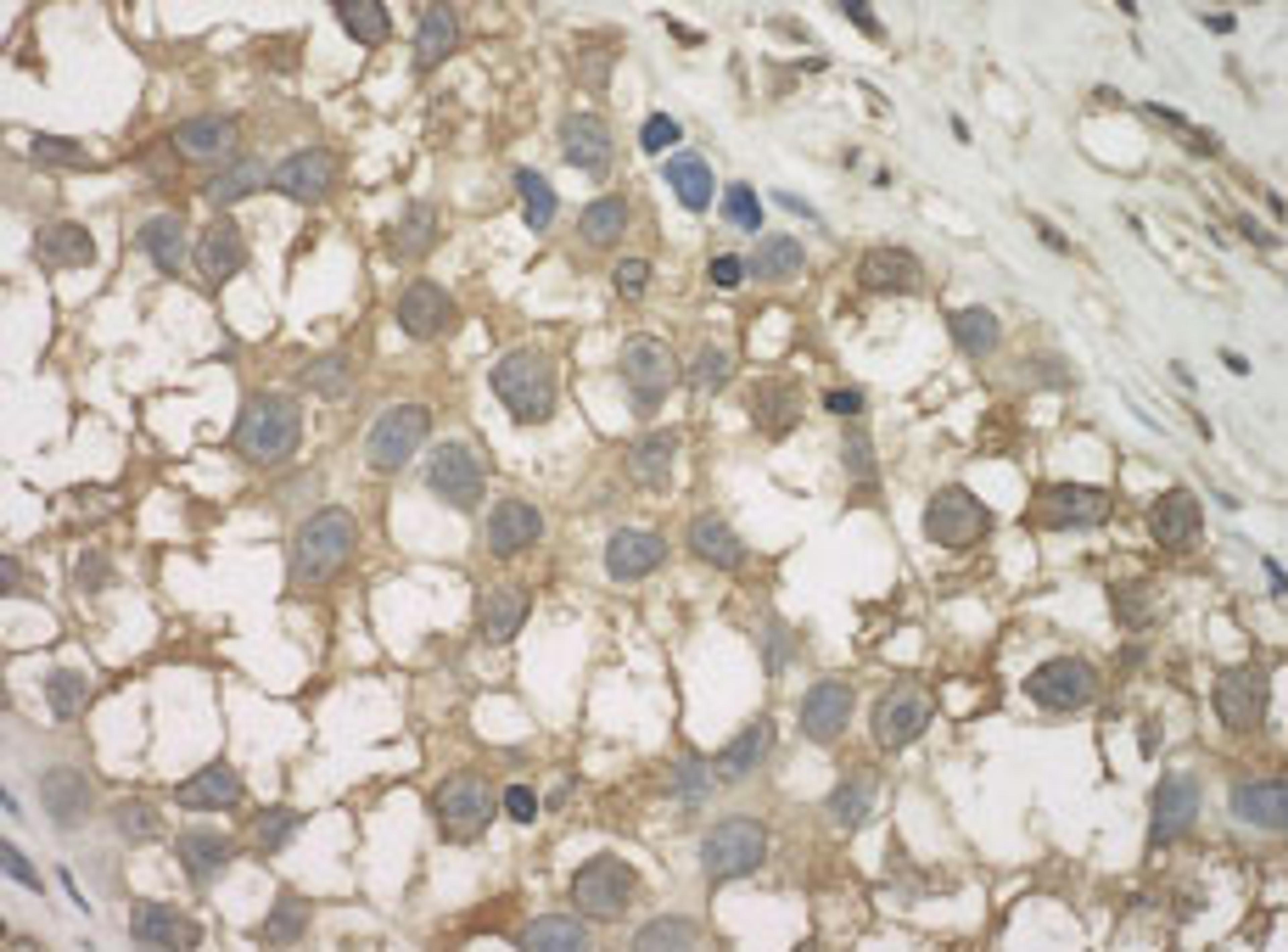 Detection of human JLP by immunohistochemistry.