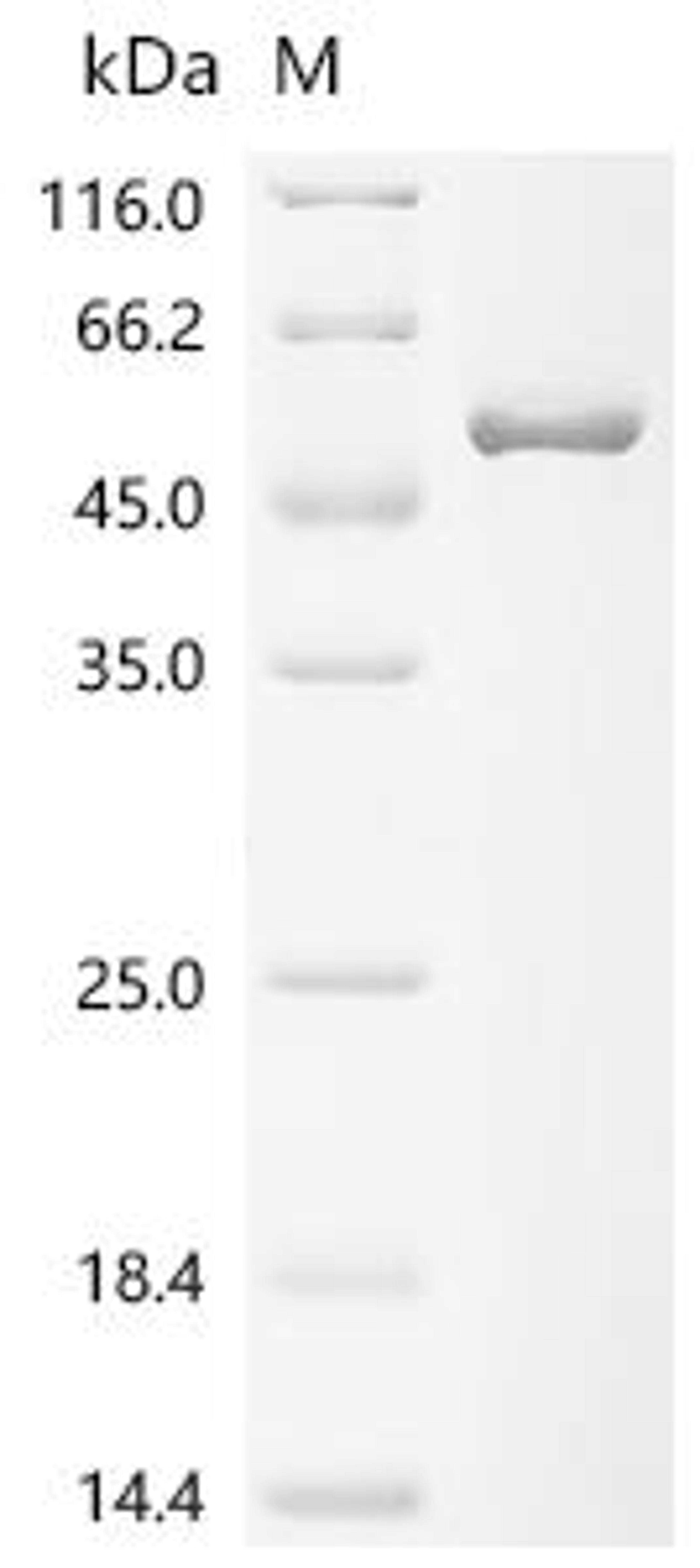 (Tris-Glycine gel) Discontinuous SDS-PAGE (reduced) with 5% enrichment gel and 15% separation gel.
