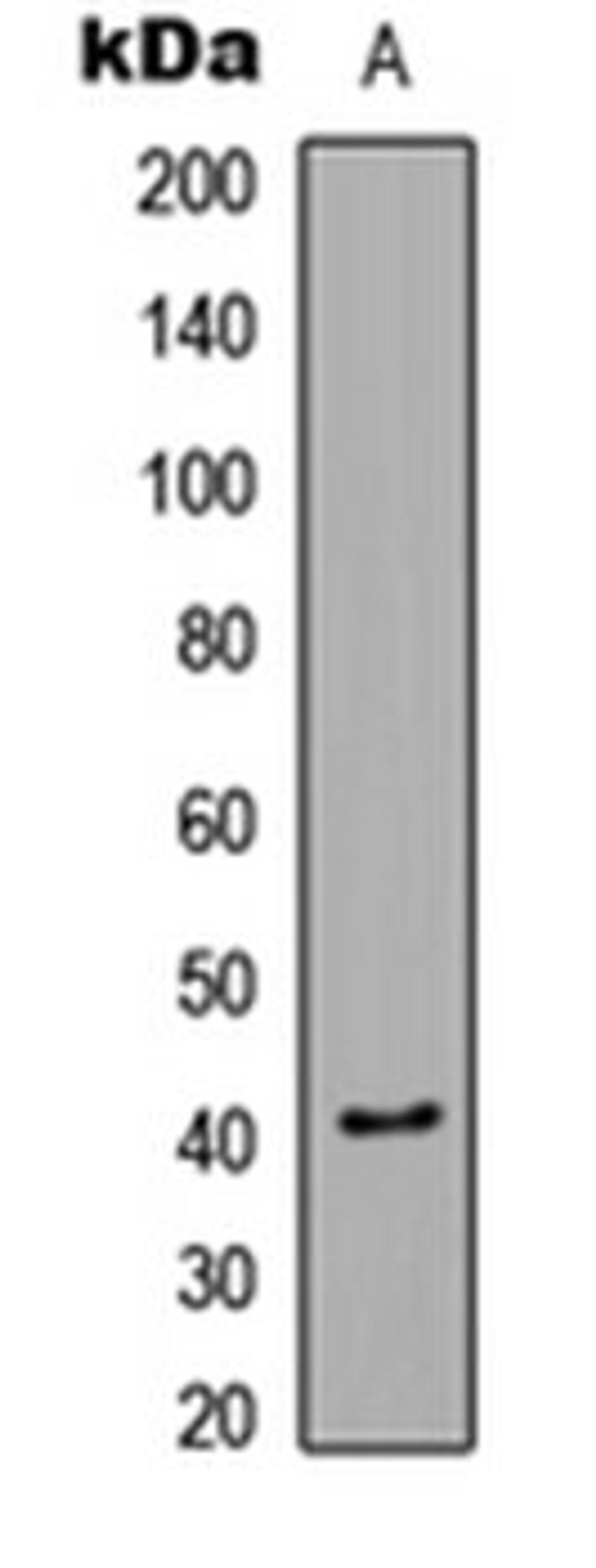 Western blot analysis of Jurkat Insulin-treated (Lane 1) whole cell lysates using CaMK1 alpha (phospho-T177) antibody