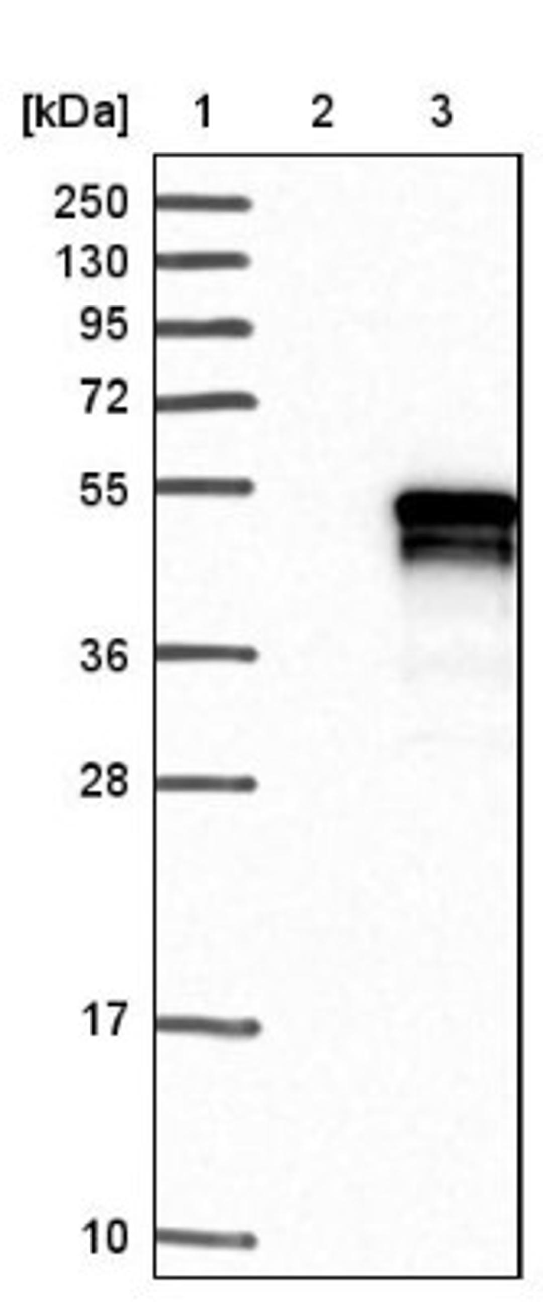 Western Blot: ANKRD40 Antibody [NBP1-93515] - Lane 1: Marker [kDa] 250, 130, 95, 72, 55, 36, 28, 17, 10<br/>Lane 2: Negative control (vector only transfected HEK293T lysate)<br/>Lane 3: Over-expression lysate (Co-expressed with a C-terminal myc-DDK tag (~3.1 kDa) in mammalian HEK293T cells, LY409432)