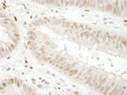 Detection of human GAPDH by immunohistochemistry.