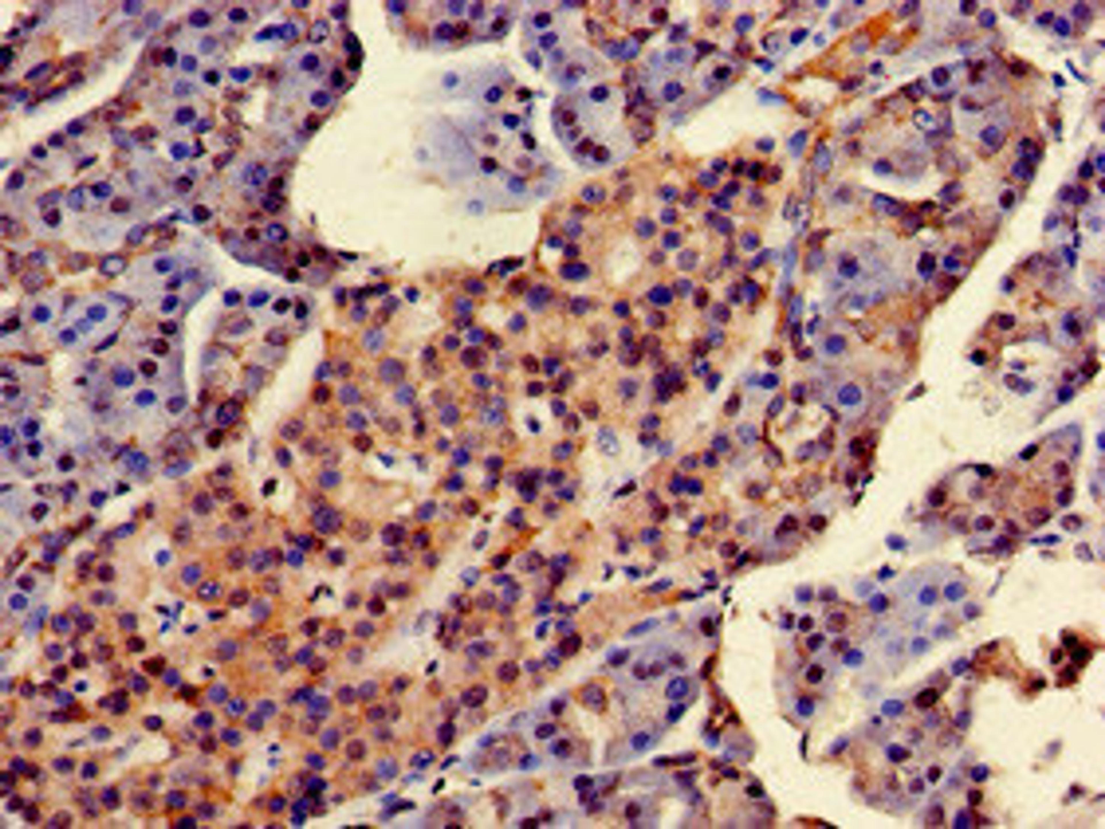 Immunohistochemistry of paraffin-embedded human pancreatic tissue using CSB-PA853100LA01HU at dilution of 1:100