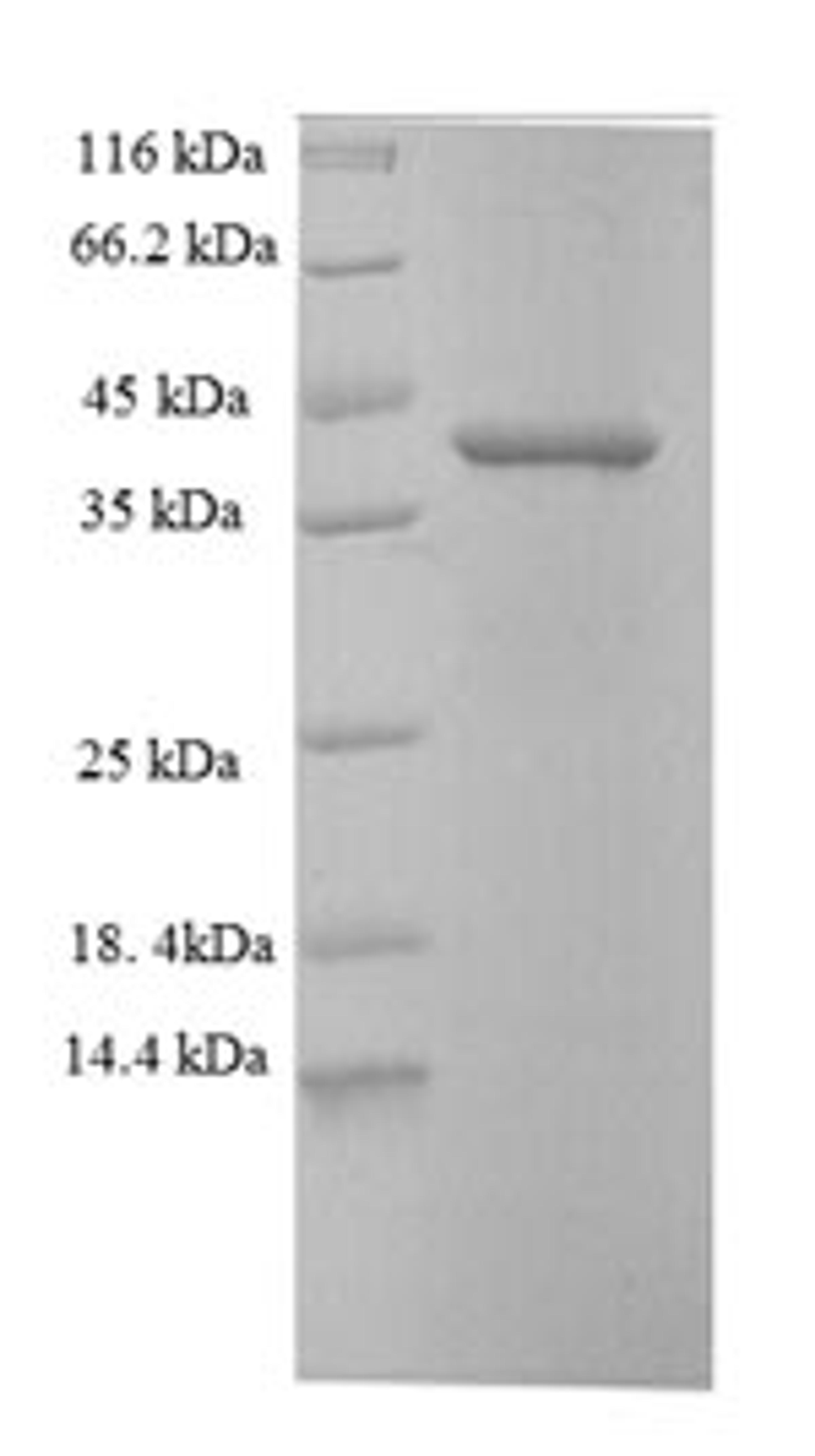 (Tris-Glycine gel) Discontinuous SDS-PAGE (reduced) with 5% enrichment gel and 15% separation gel.