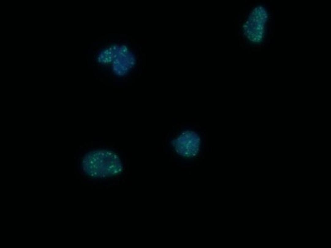 Immunocytochemistry/Immunofluorescence: 53BP1 Antibody [NB100-904] - IF analysis of 53BP1 in MEFs, HeLa, C33A and CaSki cells. Image courtesy of an anonymous customer review.