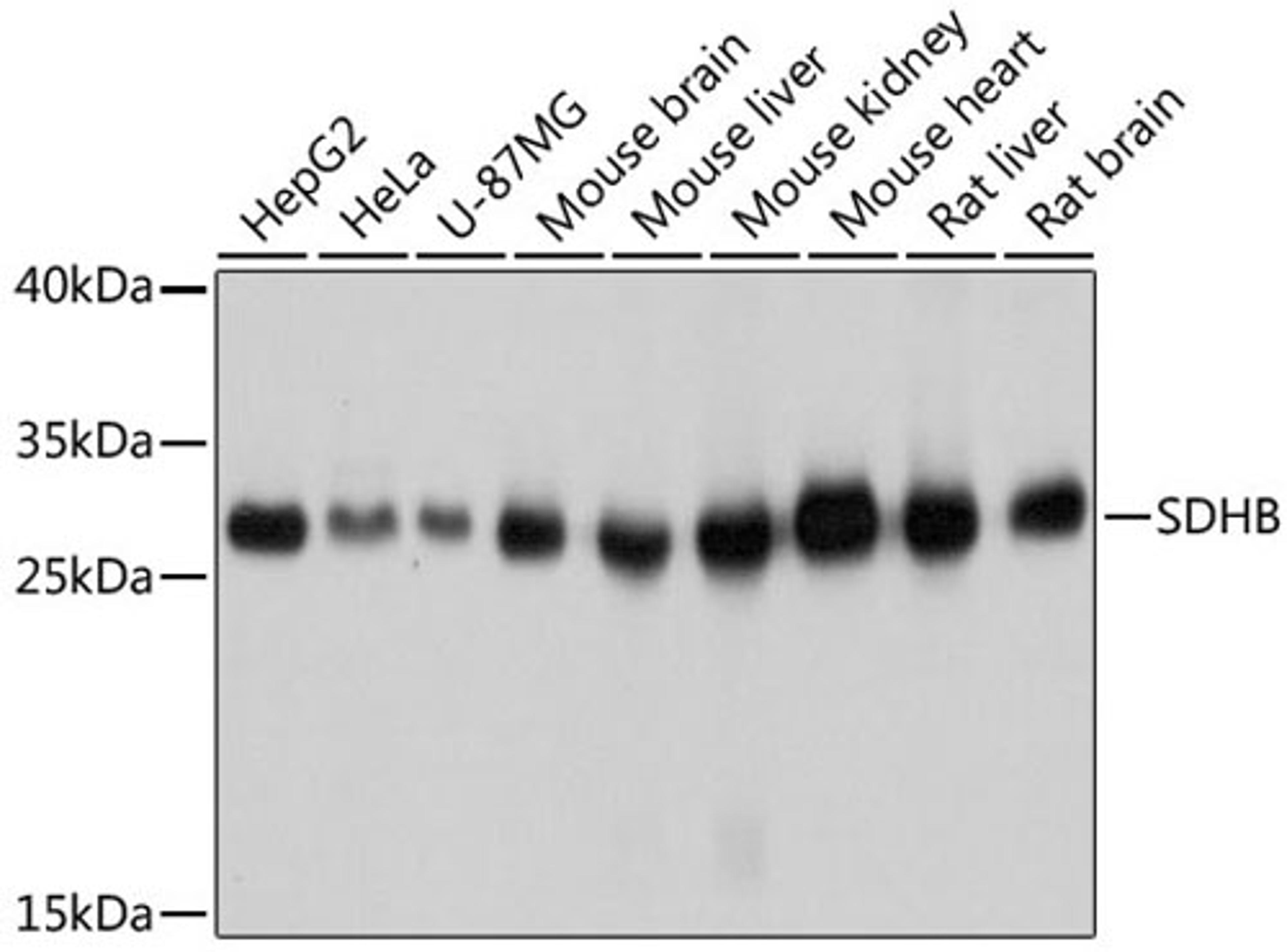 Western blot - SDHB antibody (A10821)