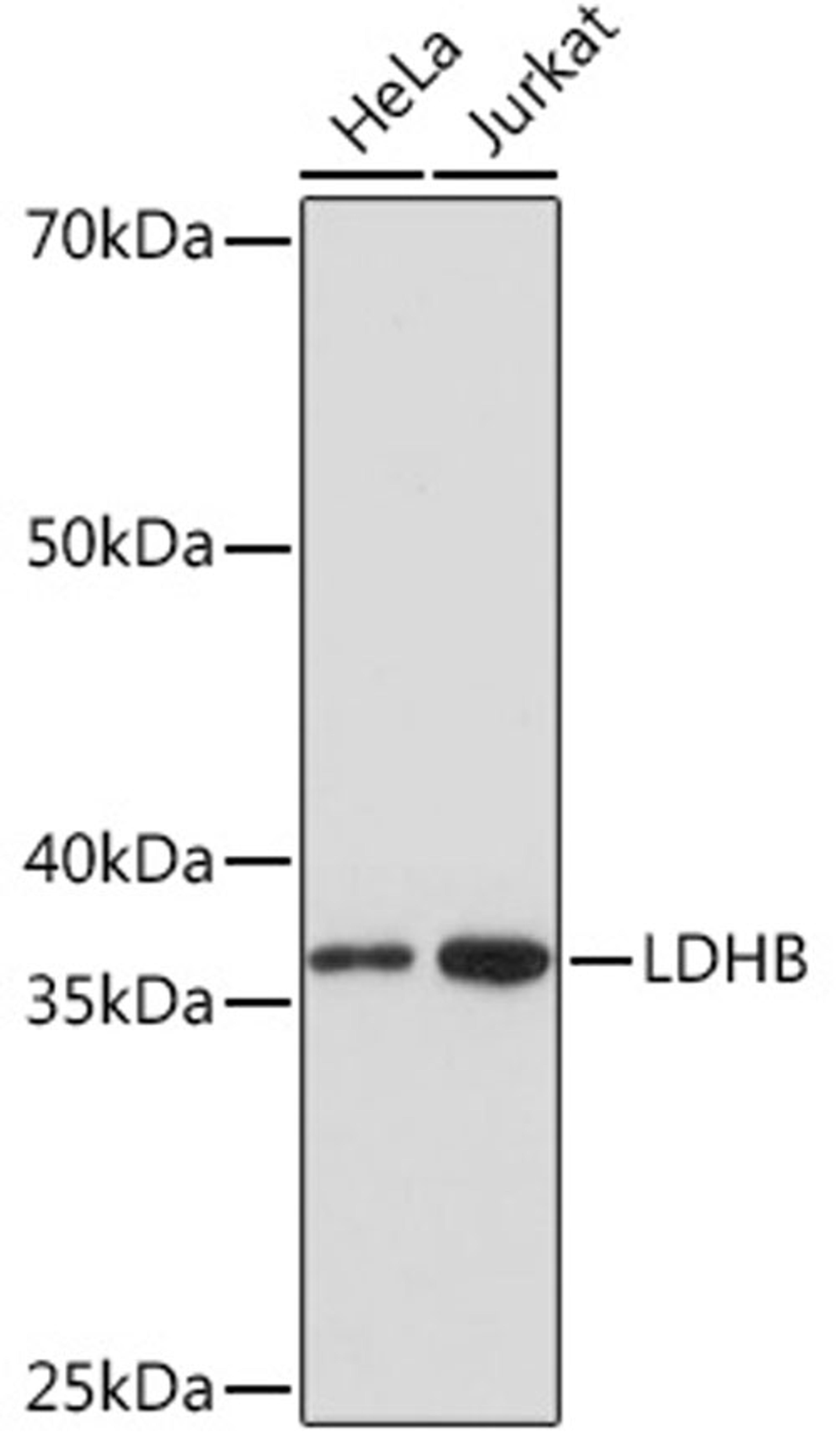 Western blot - LDHB Rabbit mAb (A5131)