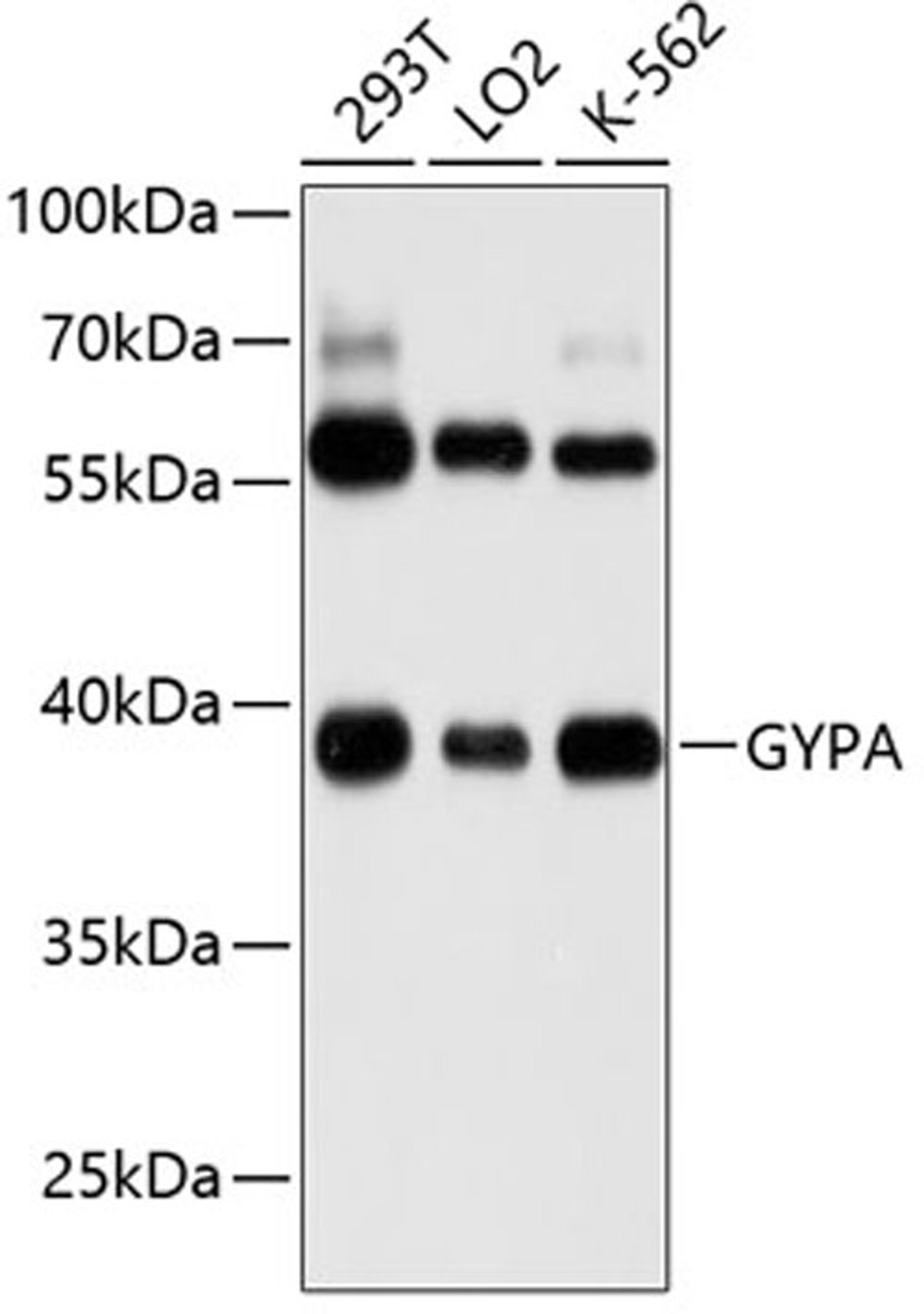 Western blot - GYPA antibody (A1827)