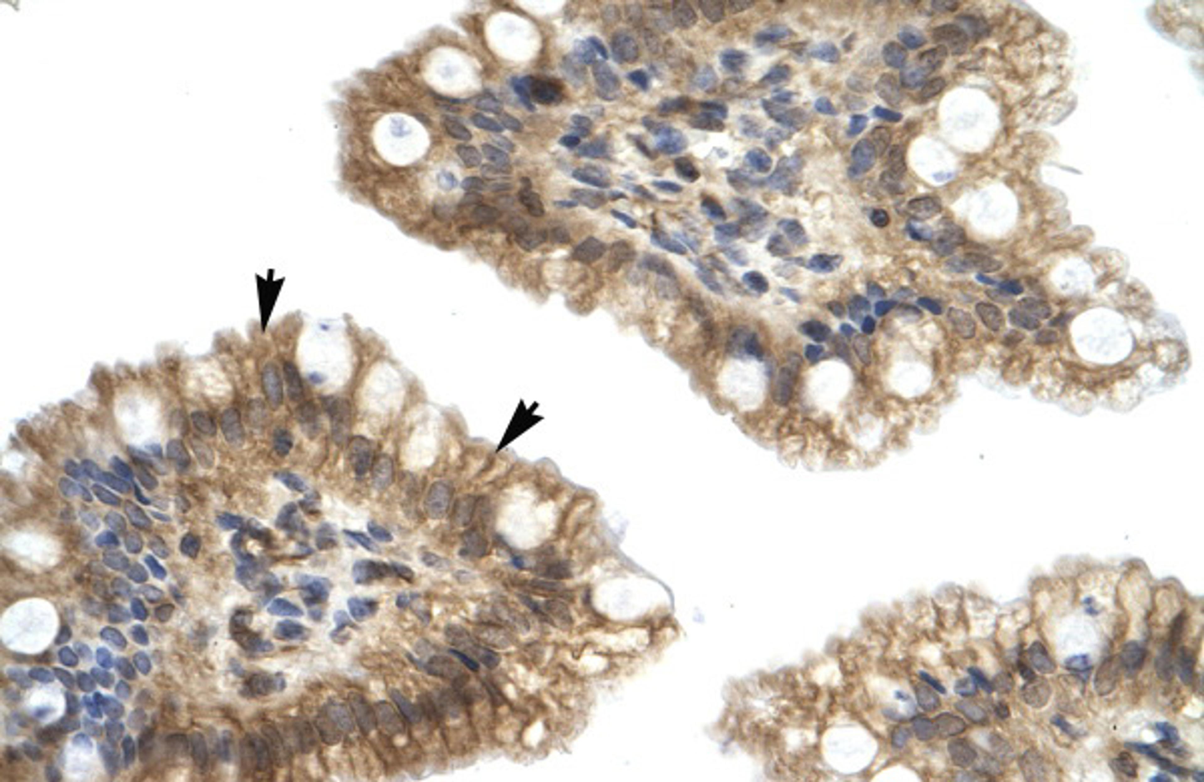 Antibody used in IHC on Human Intestine.