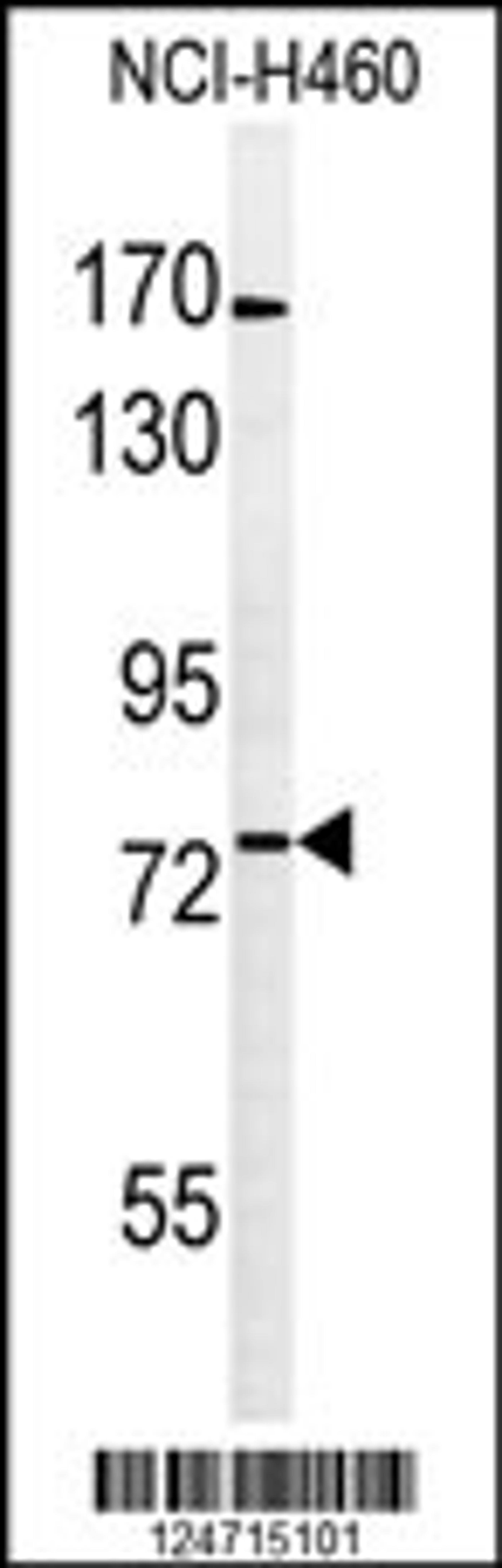 Western blot analysis of BBS10 Antibody in NCI-H460 cell line lysates (35ug/lane)