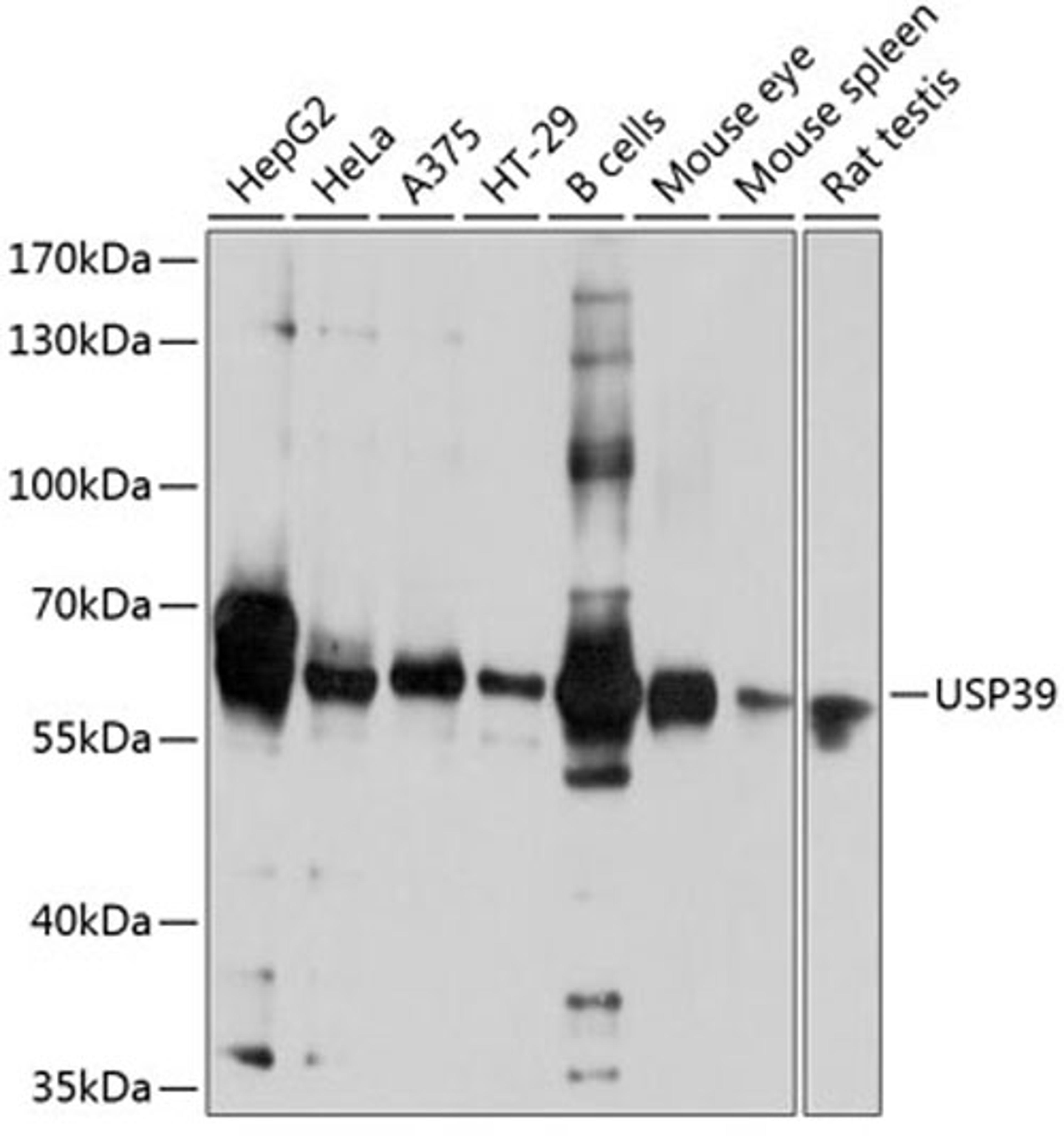 Western blot - USP39 antibody (A9582)