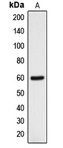 Western blot analysis of HOS (Lane 1) whole cell lysates using DCLRE1B antibody