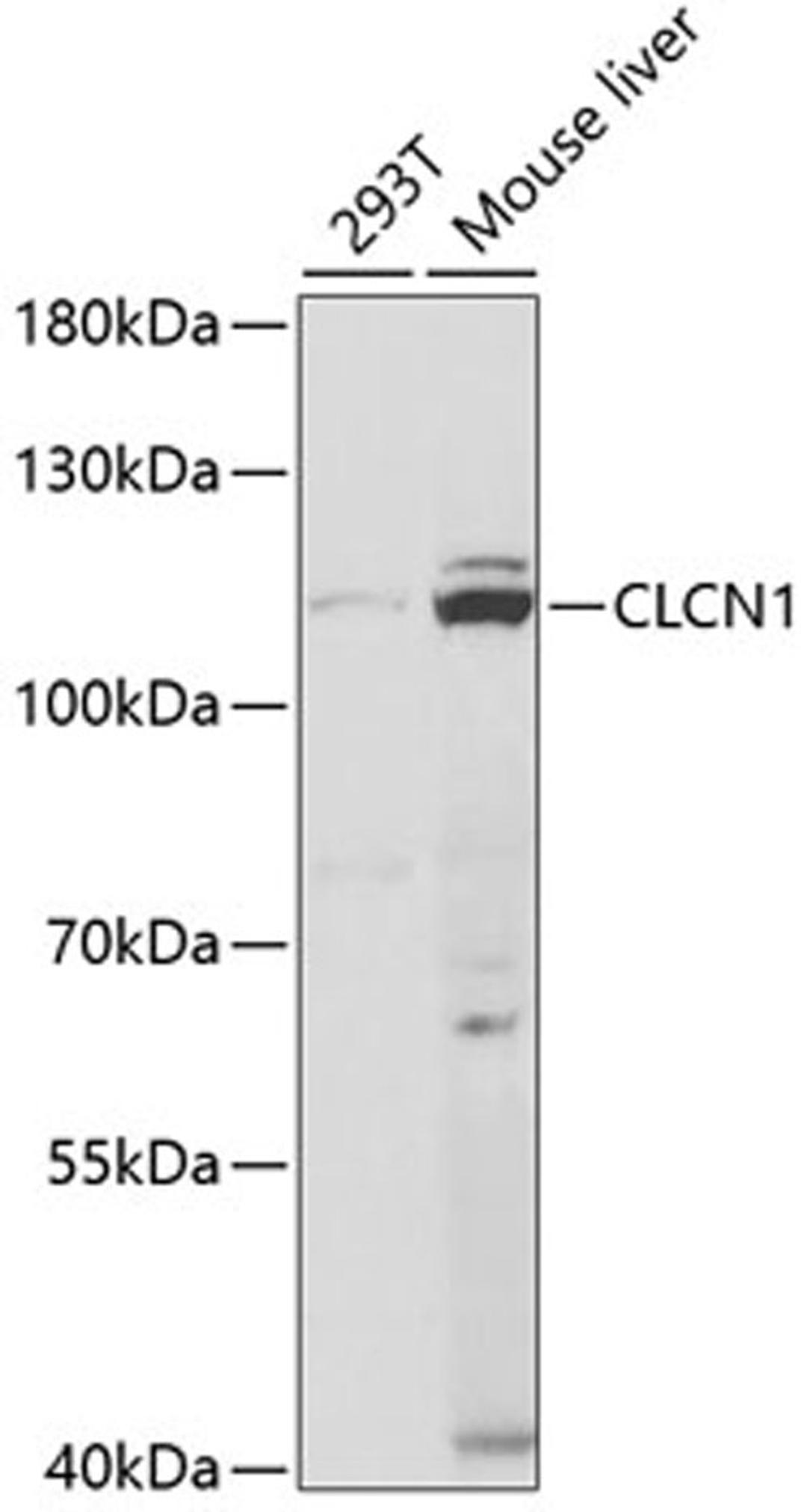 Western blot - CLCN1 antibody (A5739)