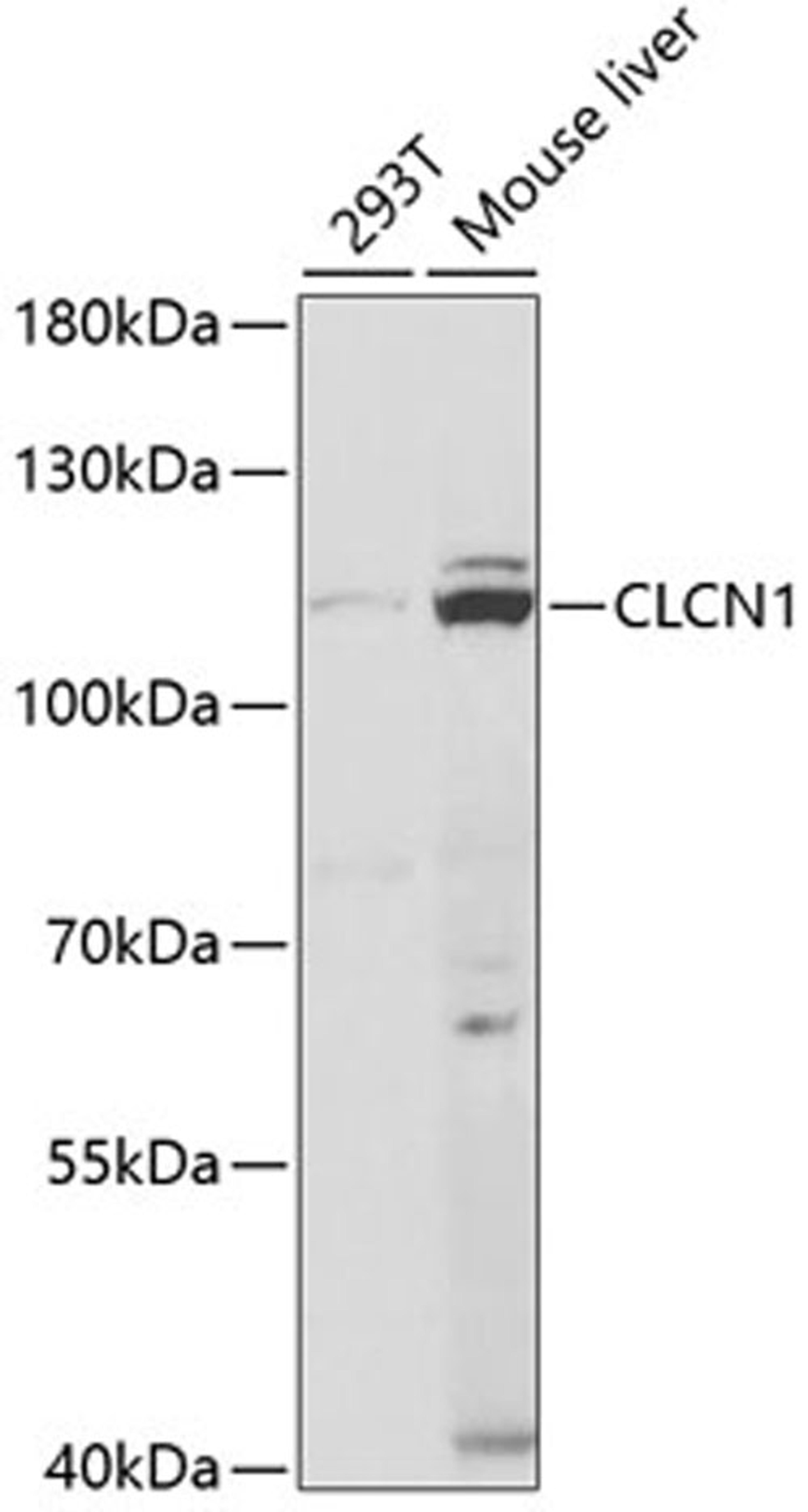 Western blot - CLCN1 antibody (A5739)