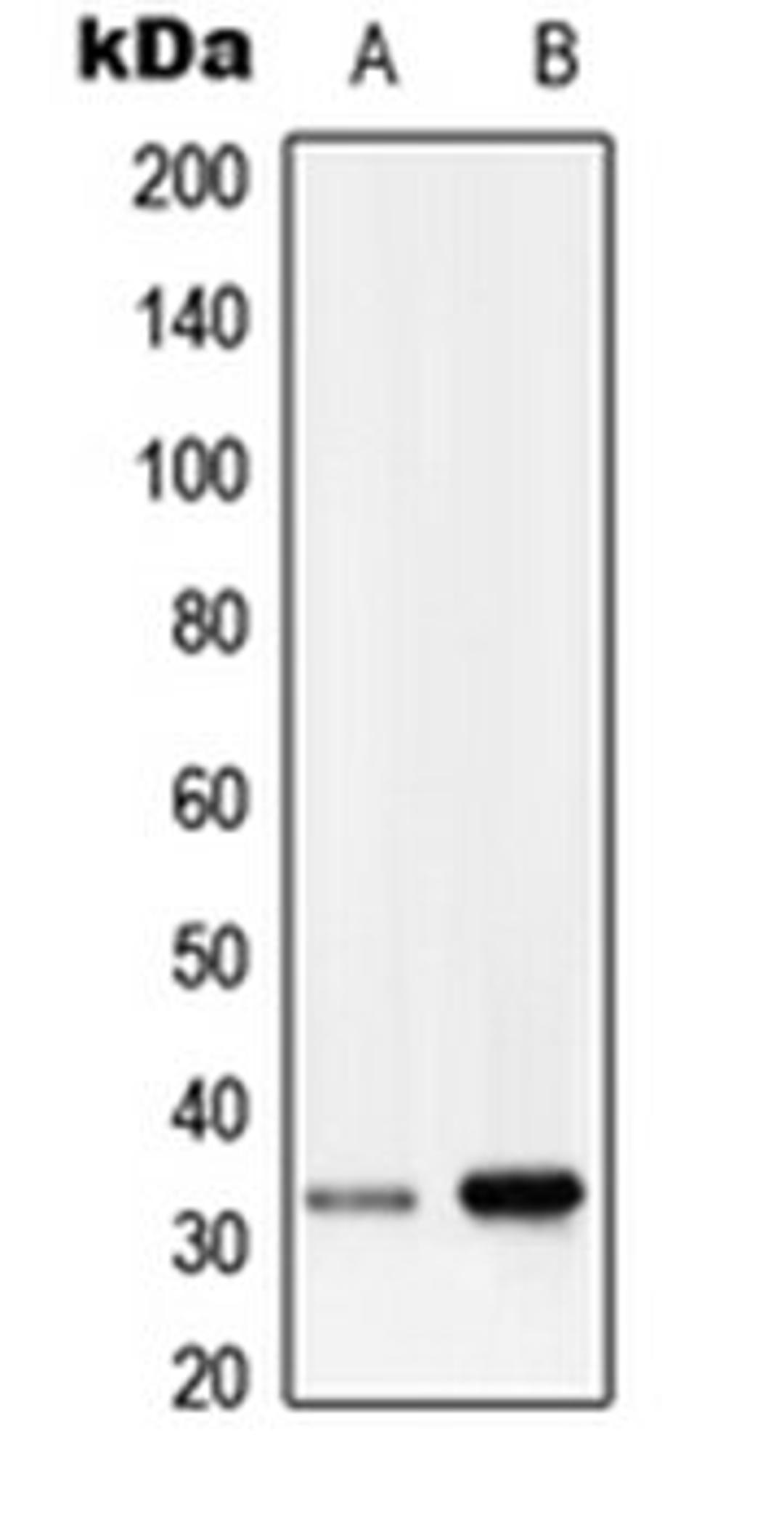 Western blot analysis of HepG2 (Lane 1), human lung (Lane 2) whole cell lysates using RRAD antibody