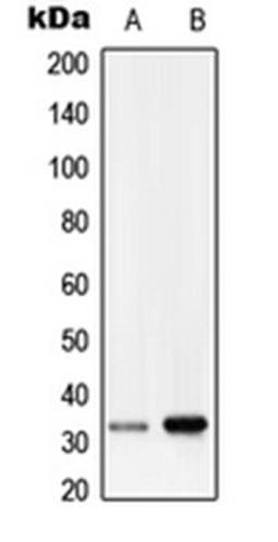 Western blot analysis of HepG2 (Lane 1), human lung (Lane 2) whole cell lysates using RRAD antibody