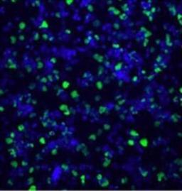 Immunocytochemistry/Immunofluorescence: Histone H3 [Citrulline 2, Citrulline 8, Citrulline 17] Antibody [NB100-57135] - HL60 cells treated with DMSO and Calcimycin Green: (at 1:1000 Blue Hoechst)