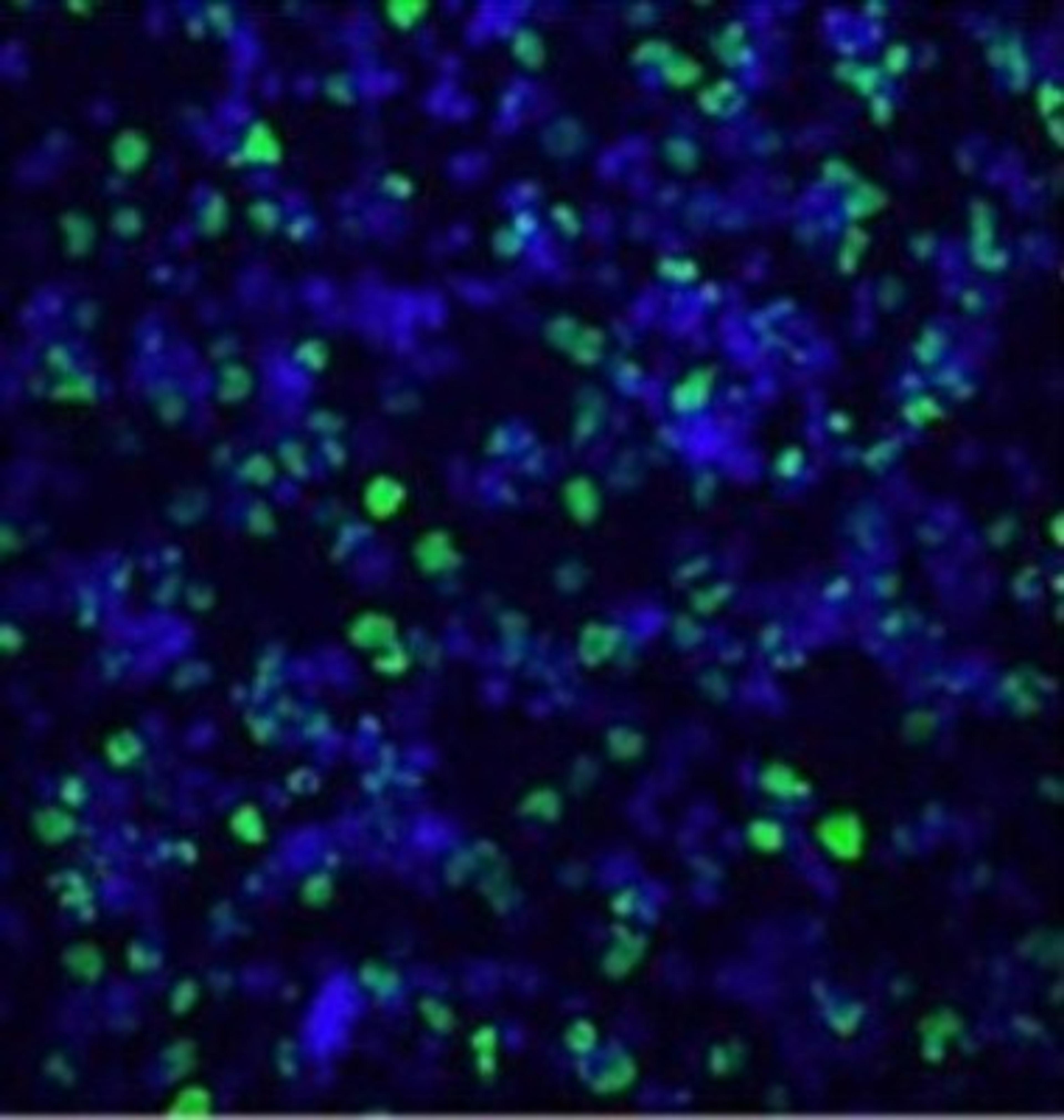 Immunocytochemistry/Immunofluorescence: Histone H3 [Citrulline 2, Citrulline 8, Citrulline 17] Antibody [NB100-57135] - HL60 cells treated with DMSO and Calcimycin Green: (at 1:1000 Blue Hoechst)