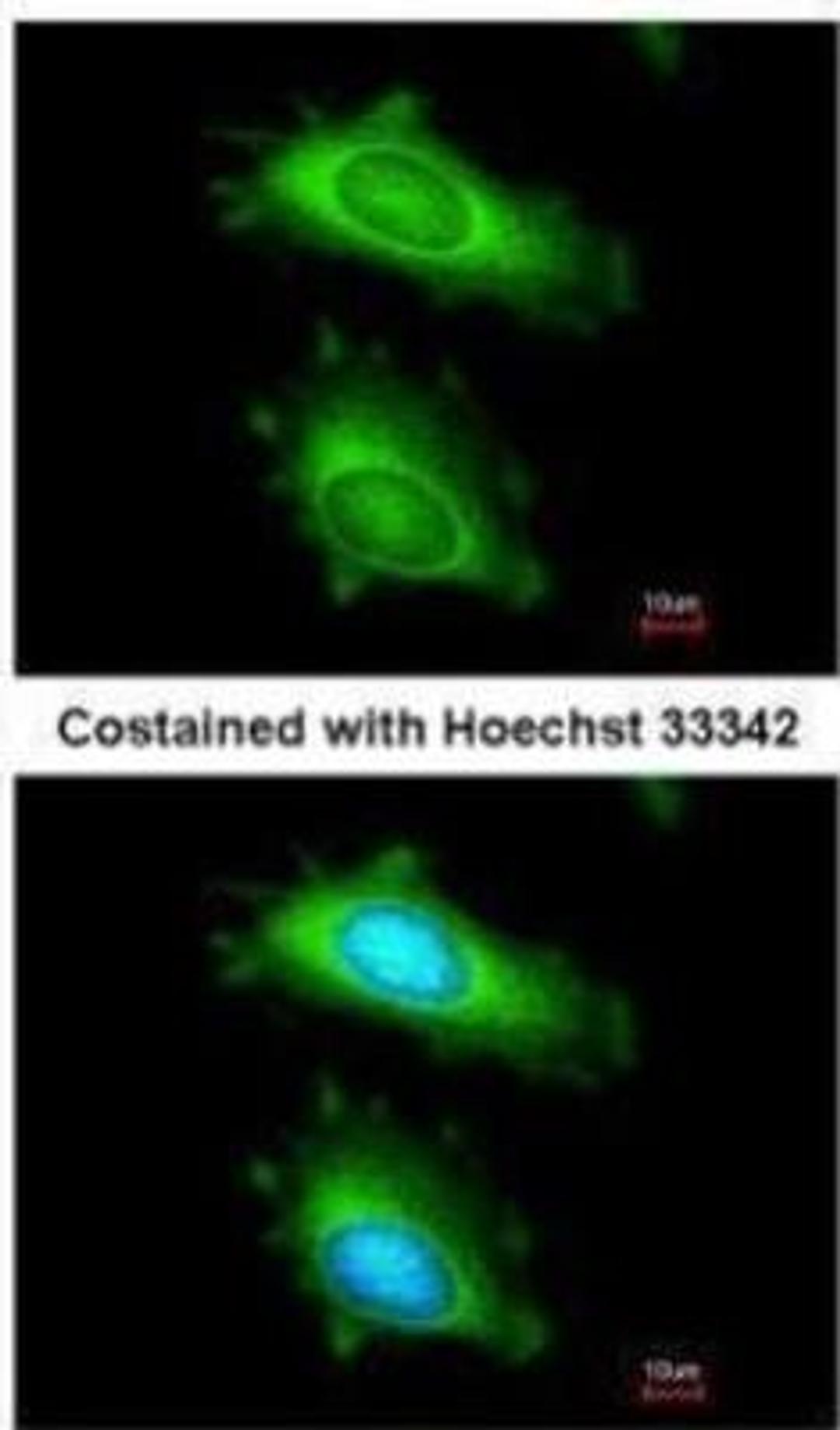 Immunocytochemistry/Immunofluorescence: MxA/Mx1 Antibody [NBP1-32905] - MX1 Antibody [NBP1-32905] - HeLa.