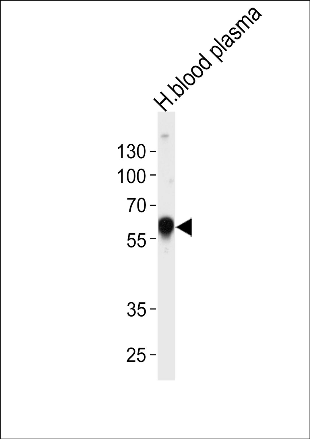 Western blot analysis of lysate from human blood plasma tissue lysate, using SERPINA1 Antibody at 1:1000 at each lane.