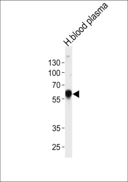 Western blot analysis of lysate from human blood plasma tissue lysate, using SERPINA1 Antibody at 1:1000 at each lane.