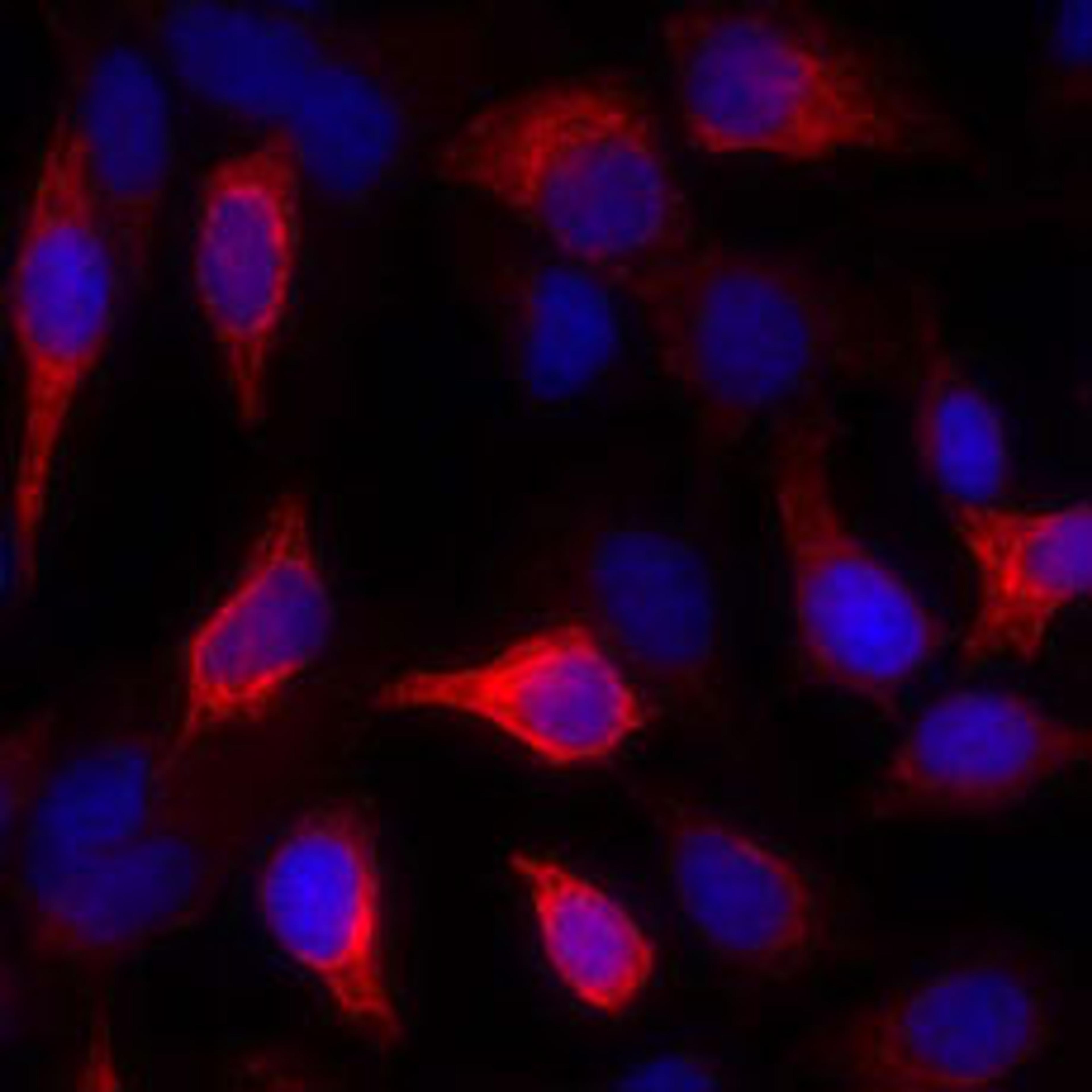 Detection of human Cytokeratin by immunocytochemistry.