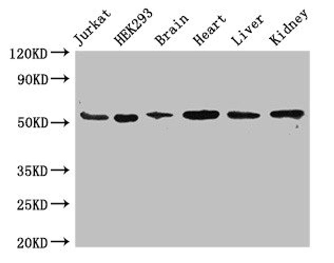 Western Blot. Positive WB detected in: Jurkat whole cell lysate, HEK293 whole cell lysate, Mouse brain tissue, Mouse heart tissue, Mouse liver tissue, Mouse kidney tissue. All lanes: SLC18A2 antibody at 3.4ug/ml. Secondary. Goat polyclonal to rabbit IgG at 1/50000 dilution. Predicted band size: 56, 23 kDa. Observed band size: 56 kDa. 