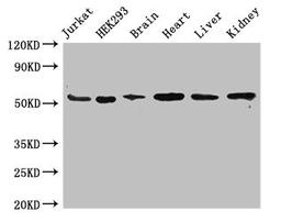 Western Blot. Positive WB detected in: Jurkat whole cell lysate, HEK293 whole cell lysate, Mouse brain tissue, Mouse heart tissue, Mouse liver tissue, Mouse kidney tissue. All lanes: SLC18A2 antibody at 3.4ug/ml. Secondary. Goat polyclonal to rabbit IgG at 1/50000 dilution. Predicted band size: 56, 23 kDa. Observed band size: 56 kDa. 