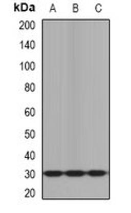 Western blot analysis of mouse brain (Lane1), mouse heart (Lane2), rat liver (Lane3) whole cell lysates using KLK10 antibody