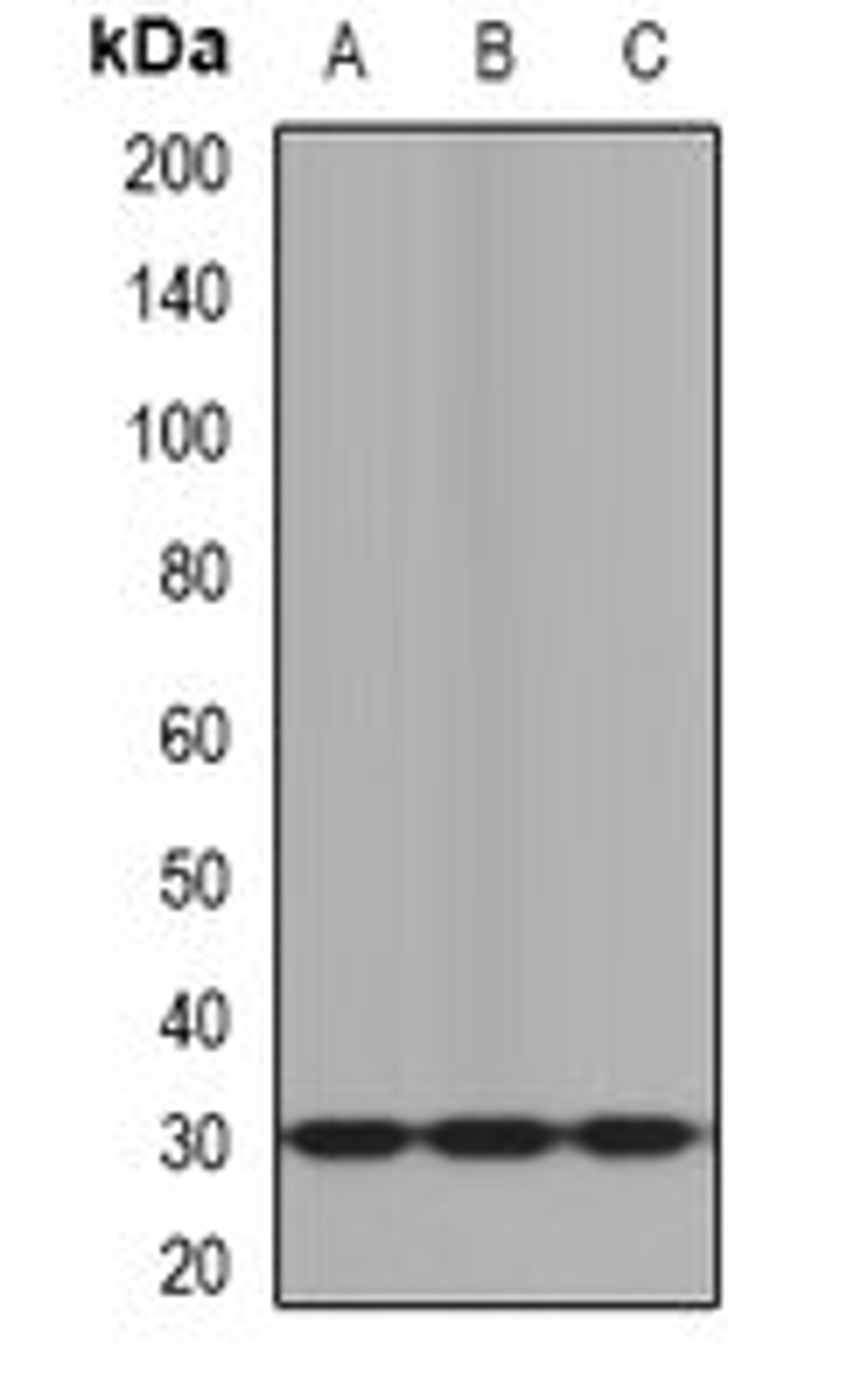 Western blot analysis of mouse brain (Lane1), mouse heart (Lane2), rat liver (Lane3) whole cell lysates using KLK10 antibody