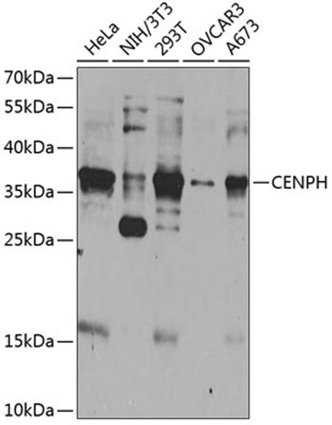 Western blot - CENPH antibody (A8372)