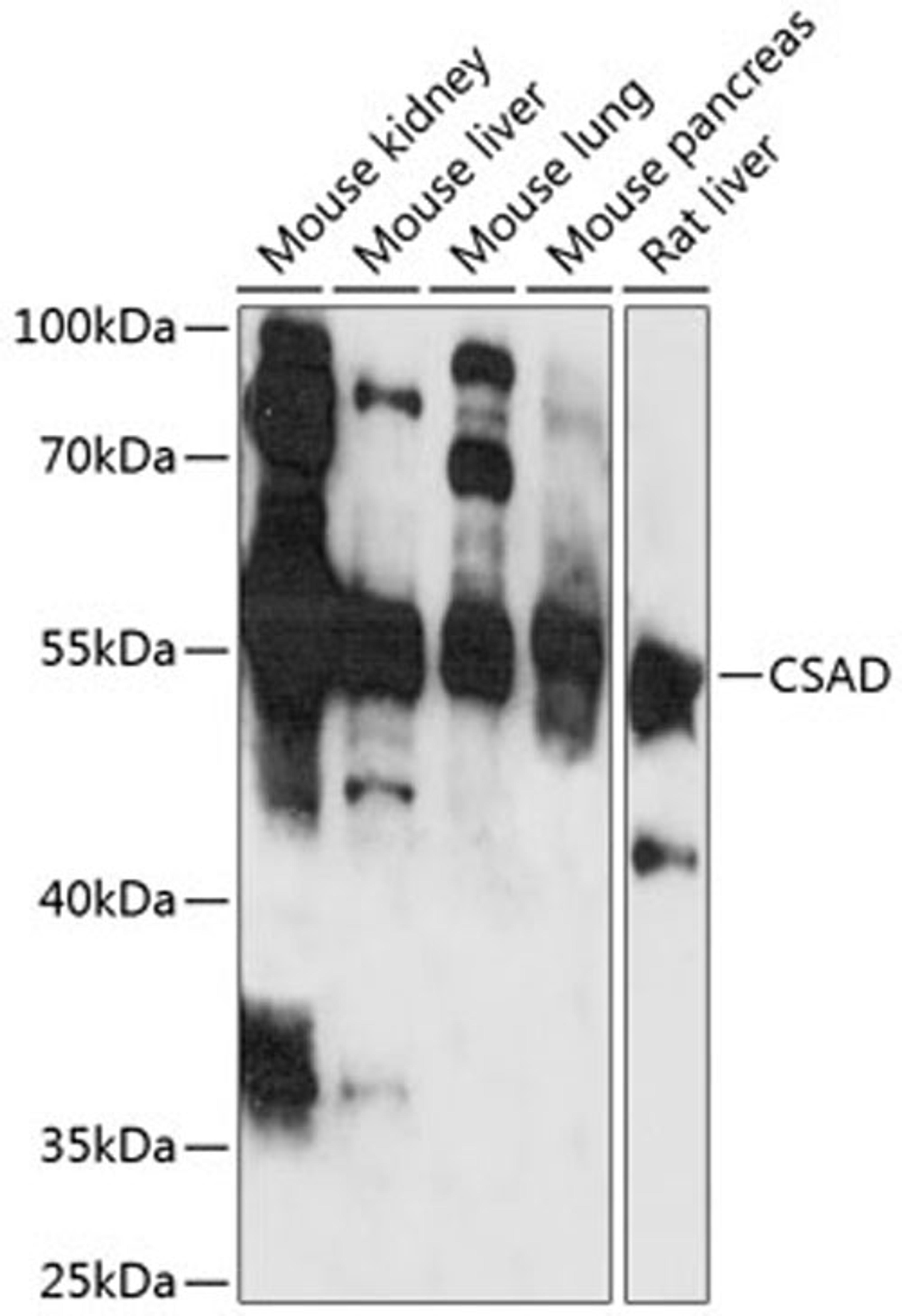 Western blot - CSAD antibody (A13845)