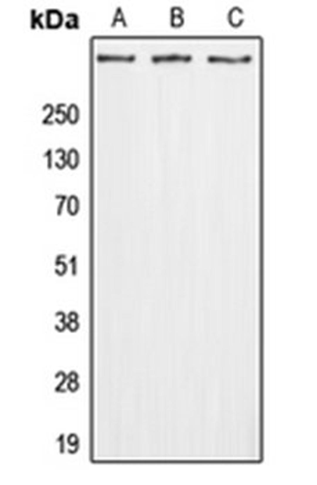 Western blot analysis of A549 (Lane 1), Raw264.7 (Lane 2), H9C2 (Lane 3) whole cell lysates using GPR112 antibody