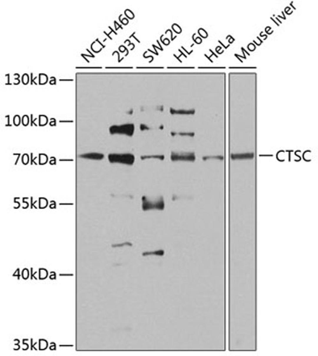 Western blot - CTSC antibody (A8403)