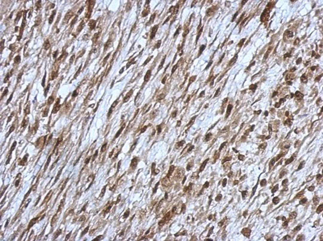 Immunohistochemistry-Paraffin: OSBPL9 Antibody [NBP2-19640] - Immunohistochemical analysis of paraffin-embedded C2C12 xenograft, using antibody at 1:500 dilution.