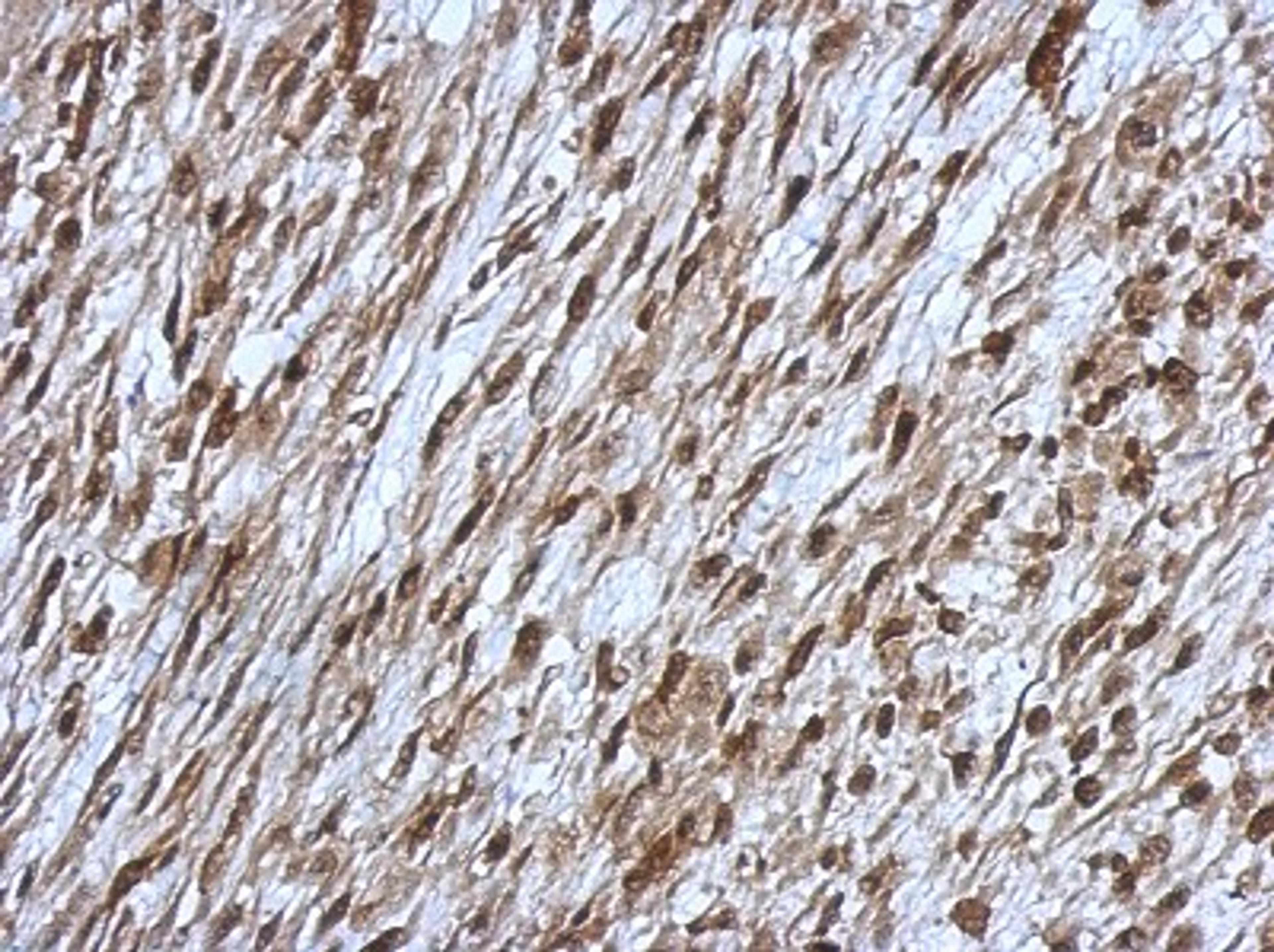 Immunohistochemistry-Paraffin: OSBPL9 Antibody [NBP2-19640] - Immunohistochemical analysis of paraffin-embedded C2C12 xenograft, using antibody at 1:500 dilution.