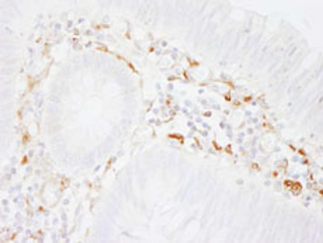 Detection of human Filamin A by immunohistochemistry.