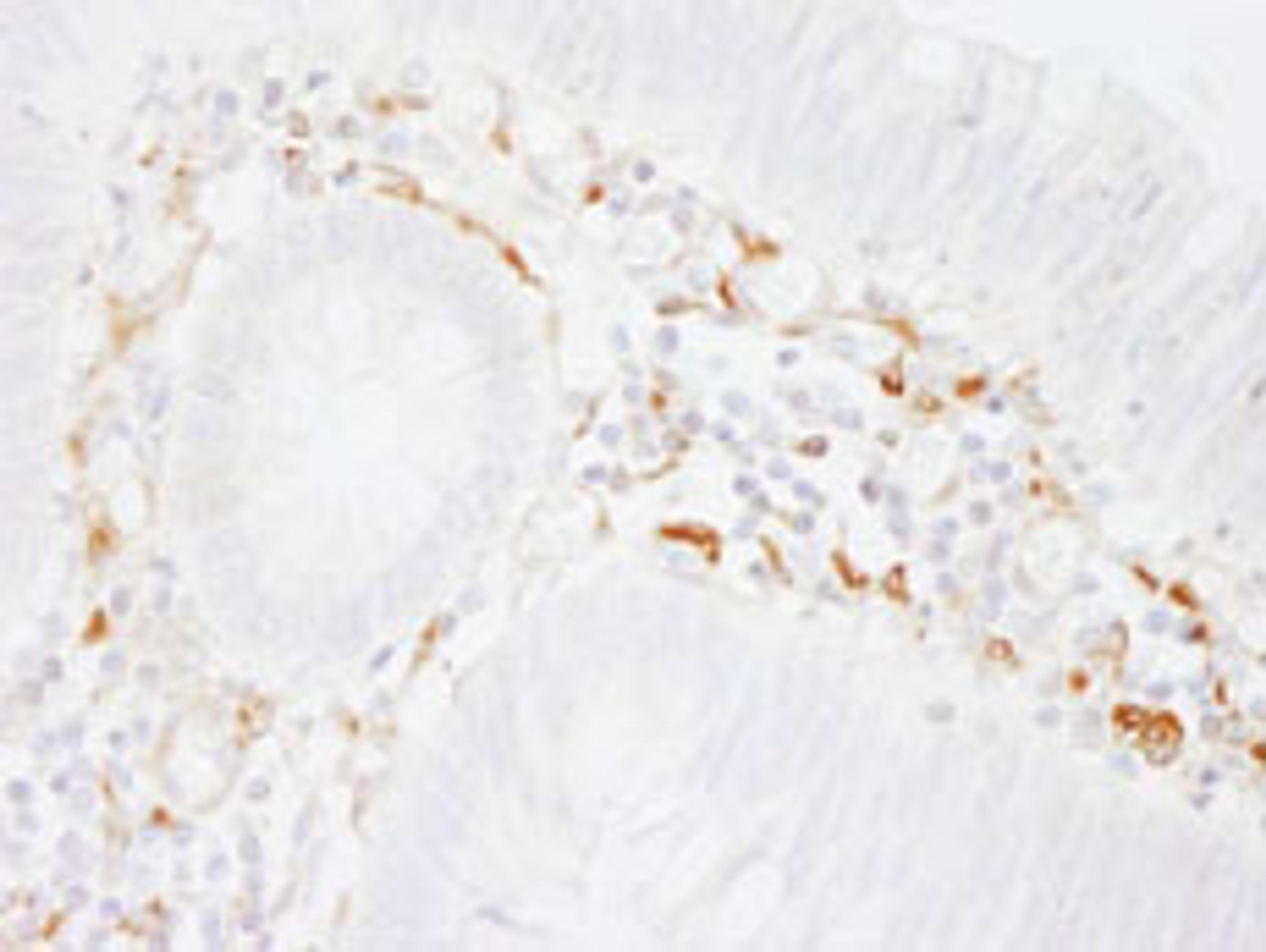 Detection of human Filamin A by immunohistochemistry.