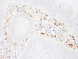 Detection of human Filamin A by immunohistochemistry.