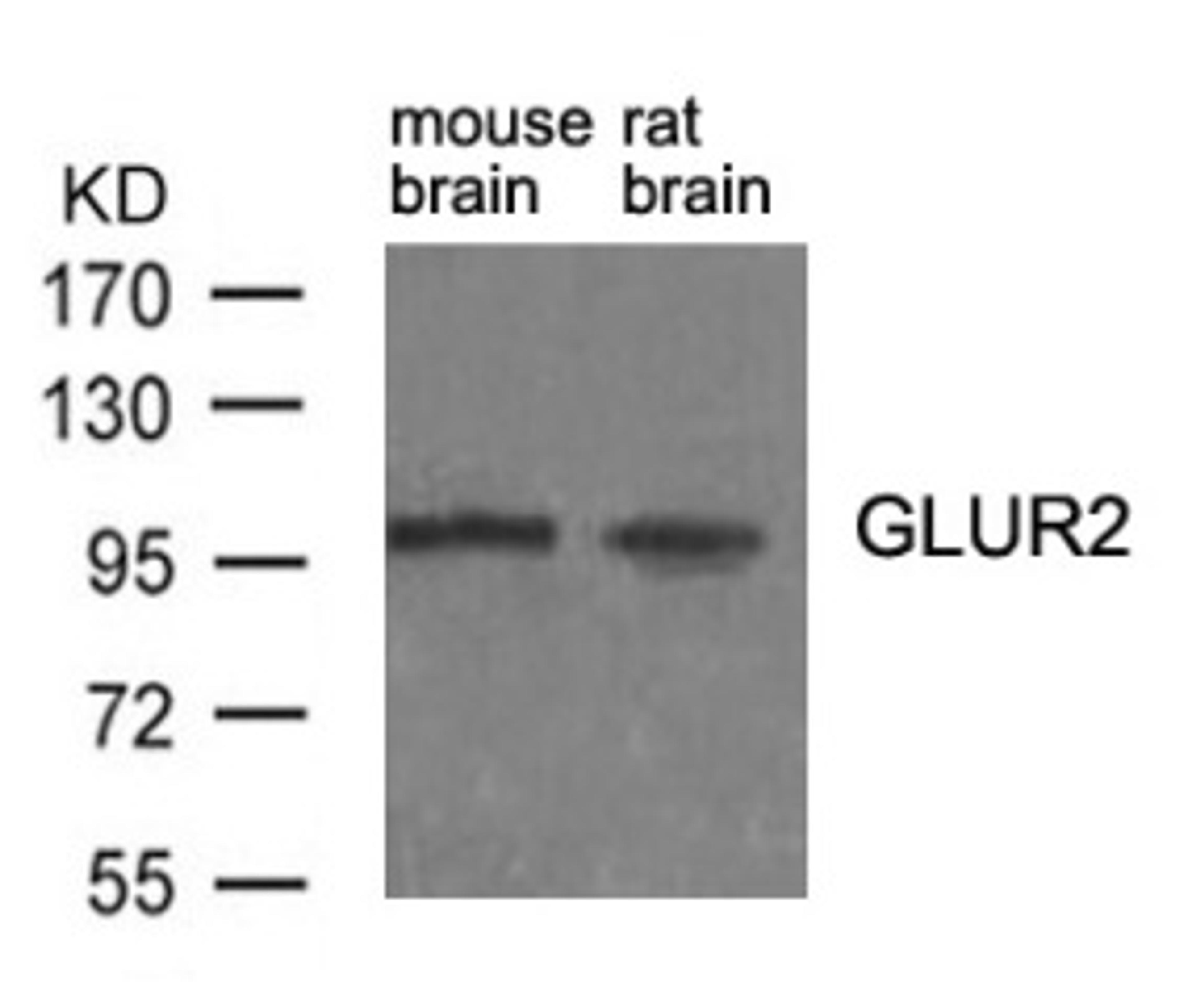 Western blot analysis of lysed extracts from mouse brain and rat brain tissue using Glutamate receptor 2 (Precursor) (Ab-880).