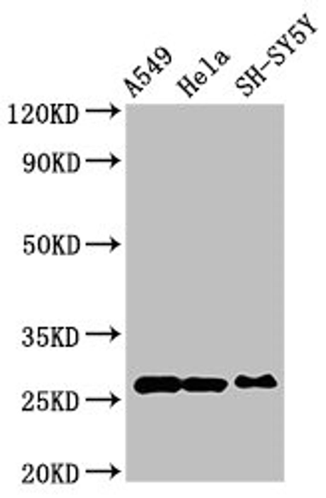 Western Blot. Positive WB detected in: A549 whole cell lysate, Hela whole cell lysate, SH-SY5Y whole cell lysate. All lanes: PRDX6 antibody at 4ug/ml. Secondary. Goat polyclonal to rabbit IgG at 1/50000 dilution. Predicted band size: 26 kDa. Observed band size: 26 kDa. 