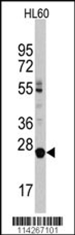 Western blot analysis of LIN28B Antibody in HL60 cell line lysates (35ug/lane)