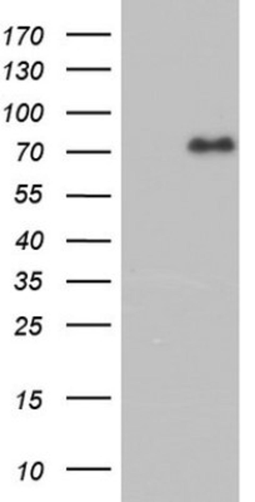 Western Blot: FAF1 Antibody (10D1) [NBP2-45565] - Analysis of HEK293T cells were transfected with the pCMV6-ENTRY control (Left lane) or pCMV6-ENTRY FAF1.