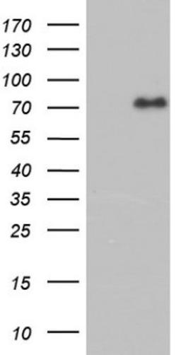 Western Blot: FAF1 Antibody (10D1) [NBP2-45565] - Analysis of HEK293T cells were transfected with the pCMV6-ENTRY control (Left lane) or pCMV6-ENTRY FAF1.