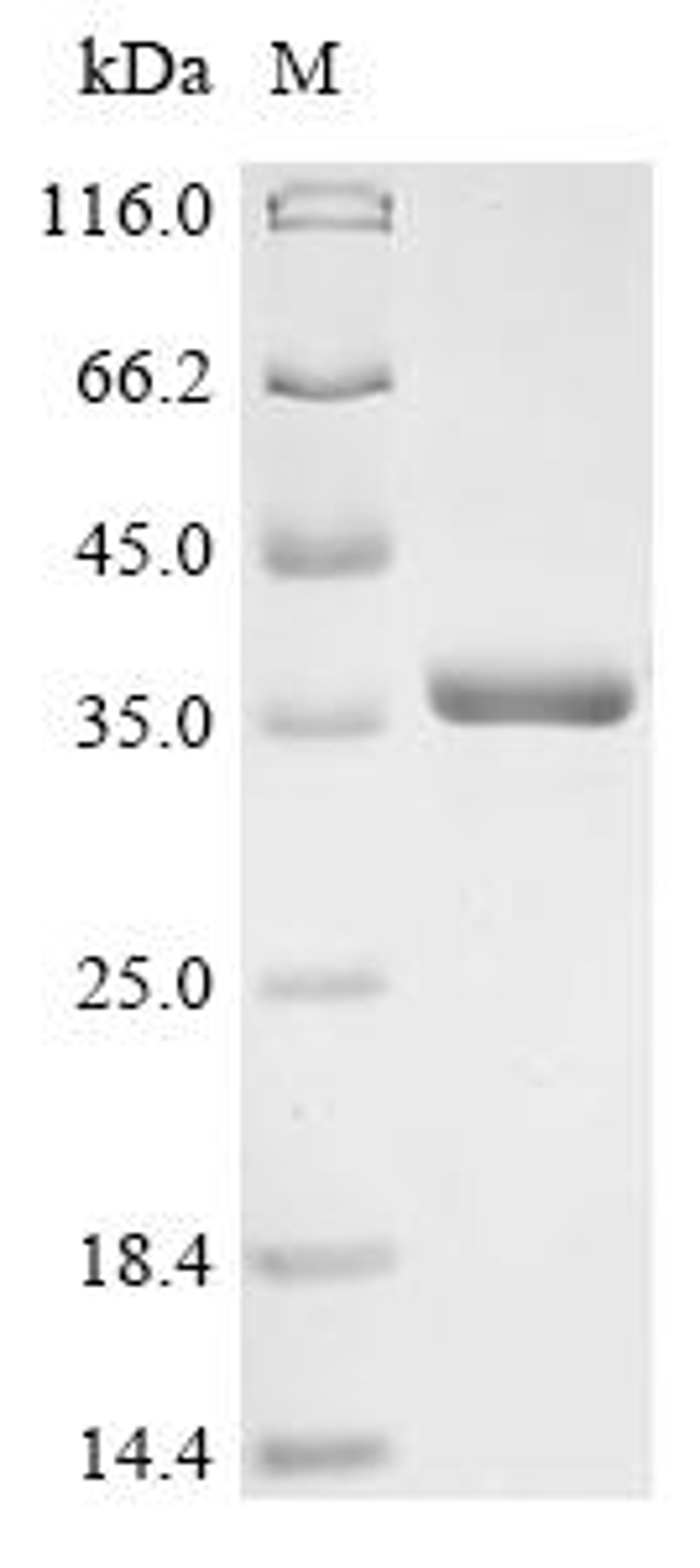 (Tris-Glycine gel) Discontinuous SDS-PAGE (reduced) with 5% enrichment gel and 15% separation gel.
