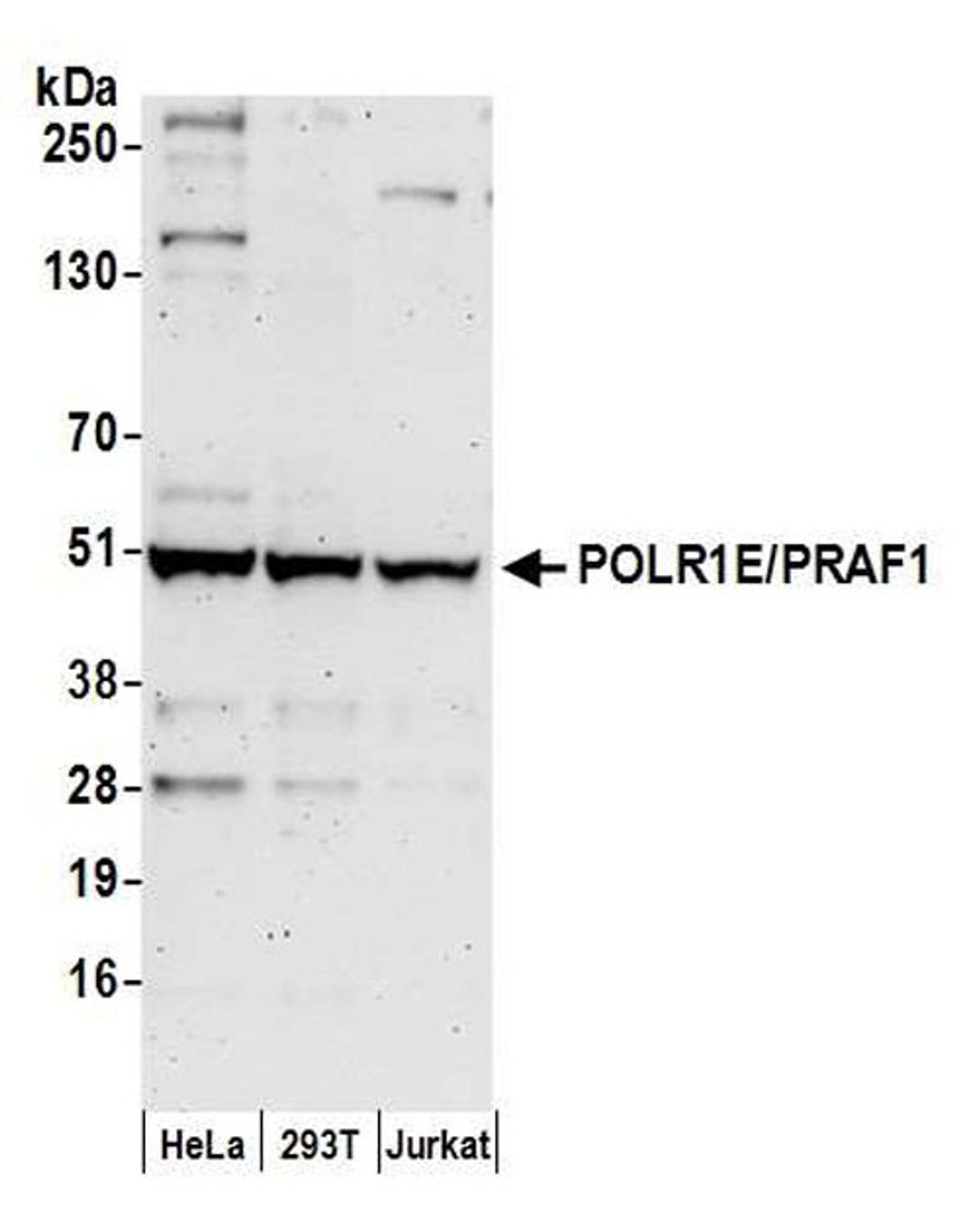 Detection of human POLR1E/PRAF1 by WB.