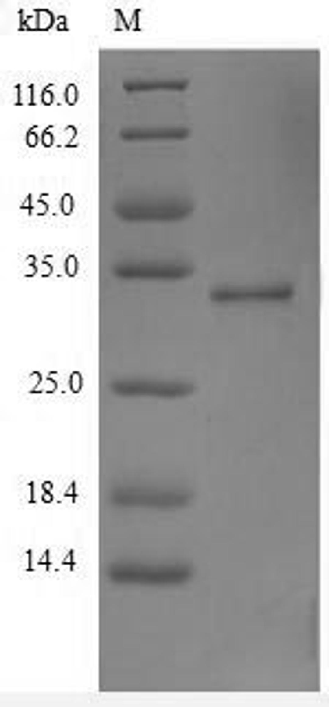 (Tris-Glycine gel) Discontinuous SDS-PAGE (reduced) with 5% enrichment gel and 15% separation gel.