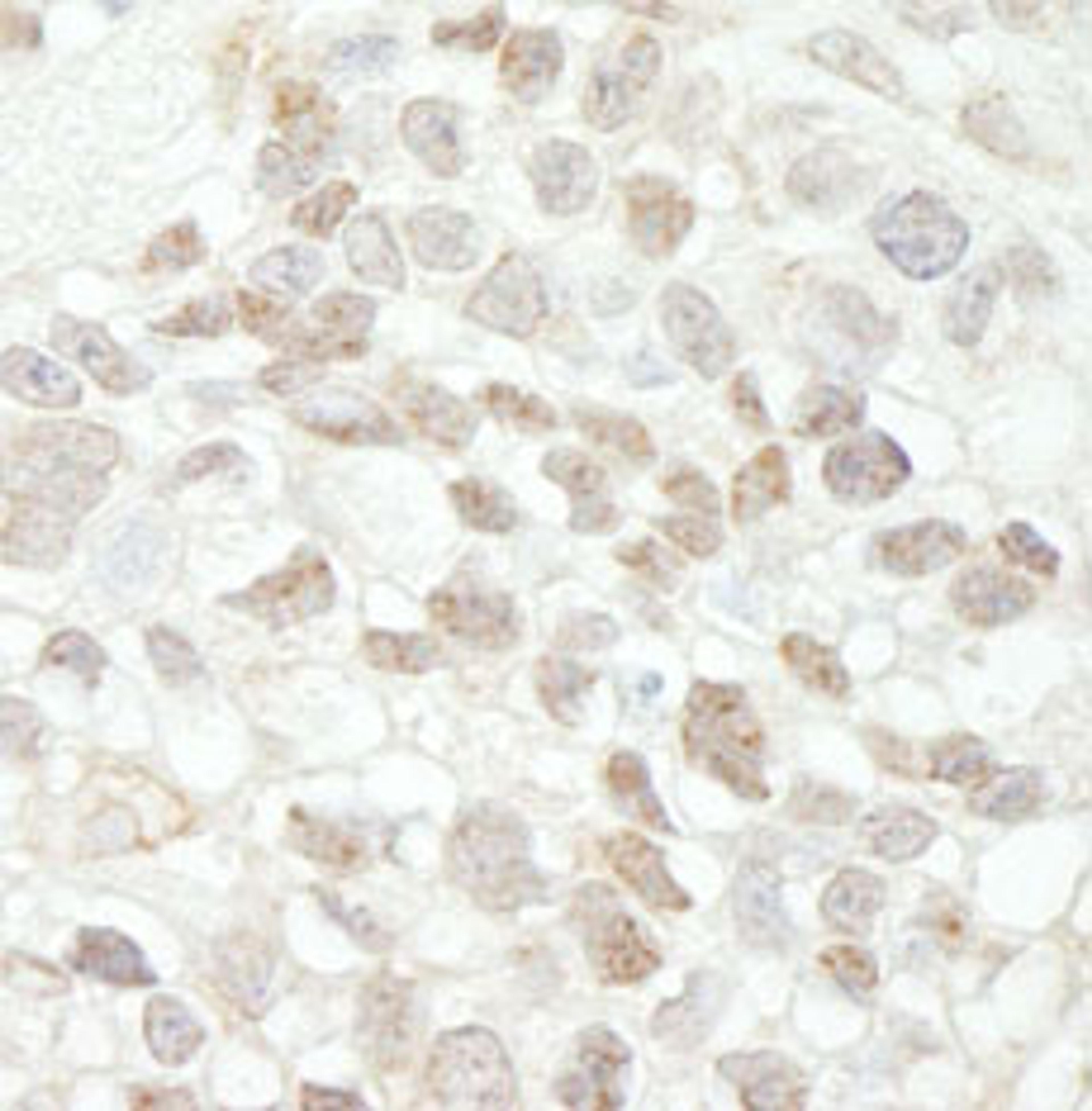 Detection of human MED18 by immunohistochemistry.