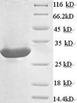 (Tris-Glycine gel) Discontinuous SDS-PAGE (reduced) with 5% enrichment gel and 15% separation gel.