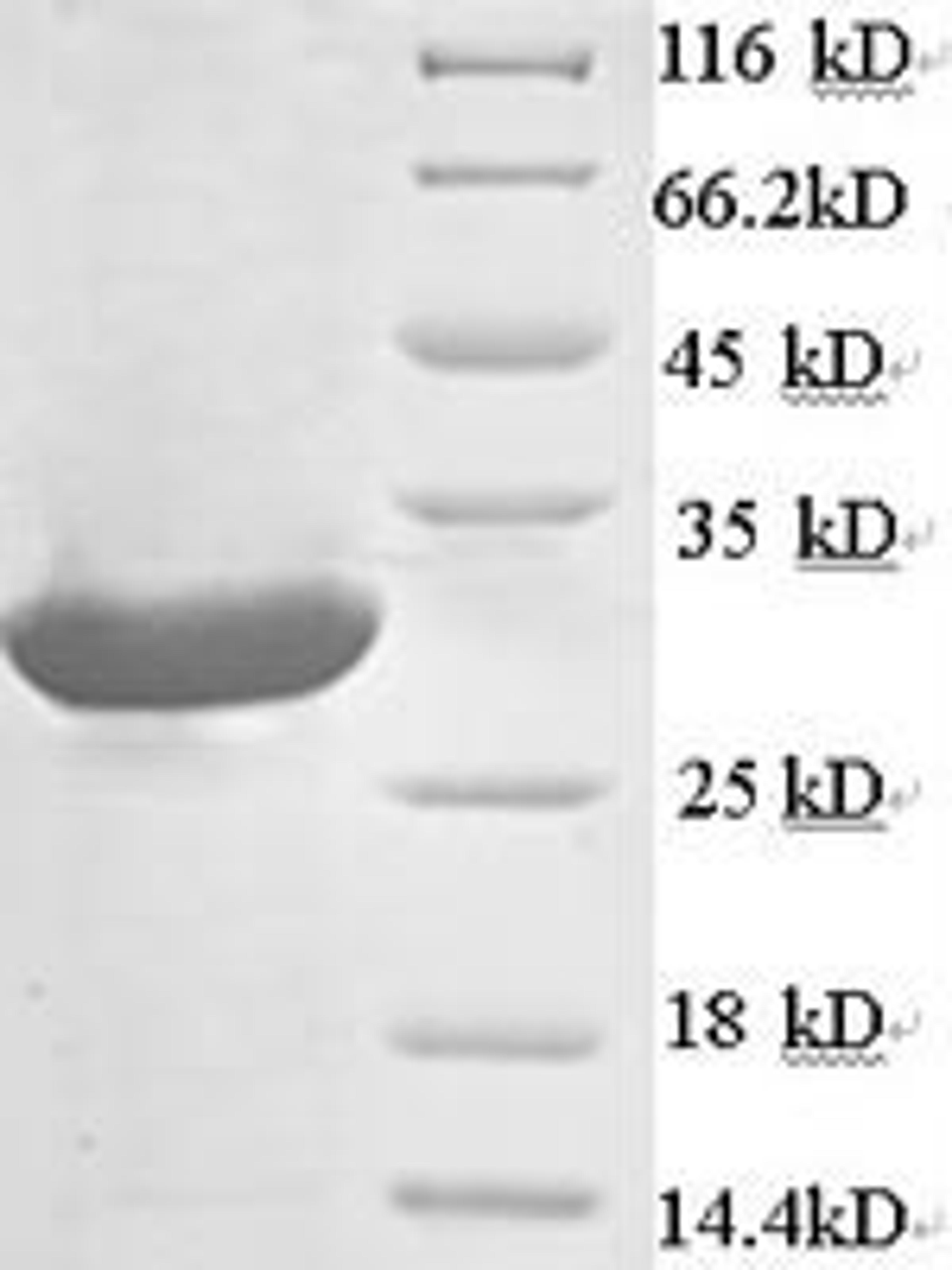(Tris-Glycine gel) Discontinuous SDS-PAGE (reduced) with 5% enrichment gel and 15% separation gel.