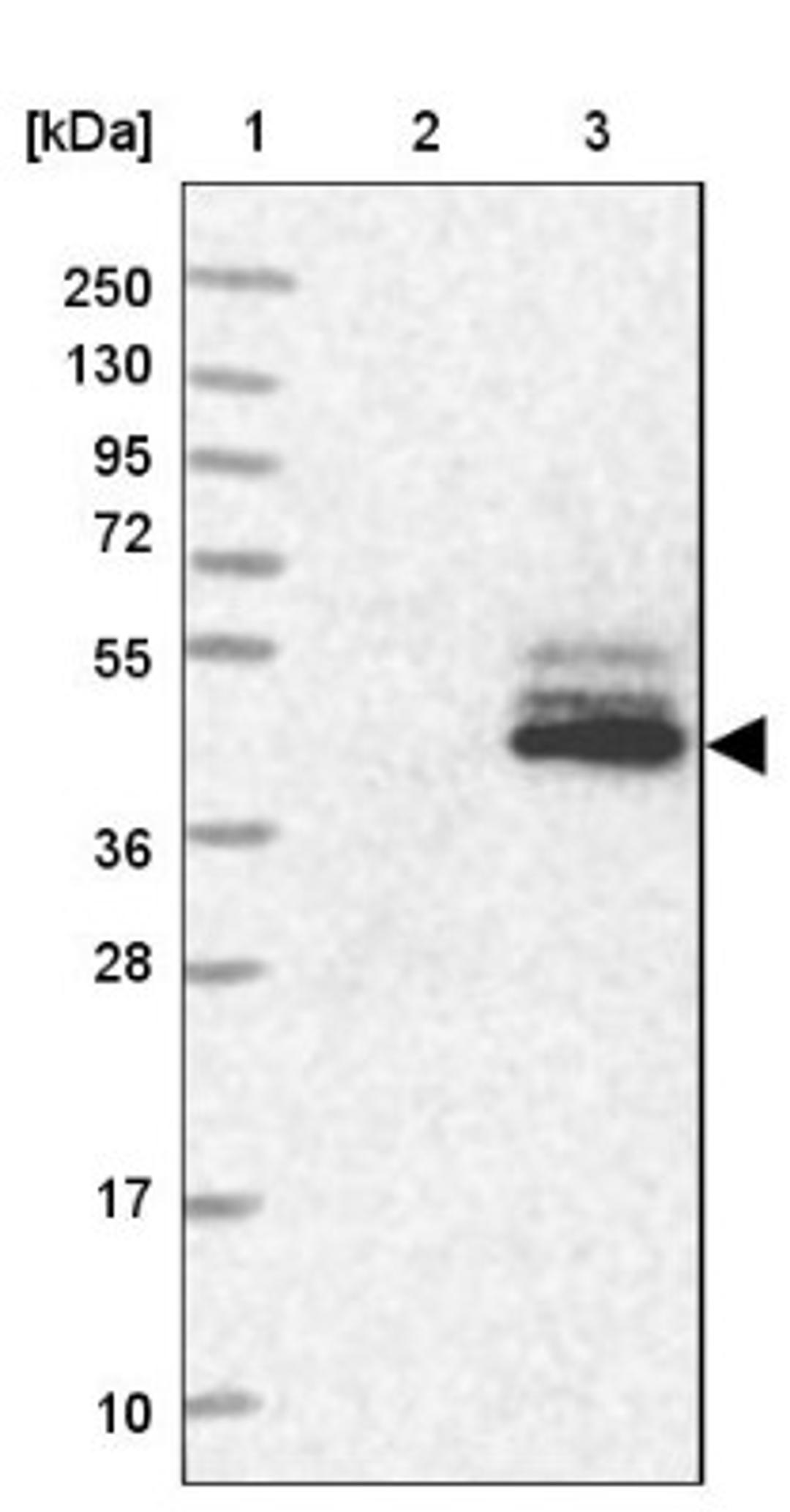 Western Blot: C5orf36 Antibody [NBP1-88257] - Lane 1: Marker [kDa] 250, 130, 95, 72, 55, 36, 28, 17, 10<br/>Lane 2: Human cell line RT-4<br/>Lane 3: Human cell line U-251MG sp